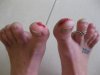 Stubbed toes 2.jpg