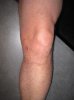 Left leg knee pain 2.jpg