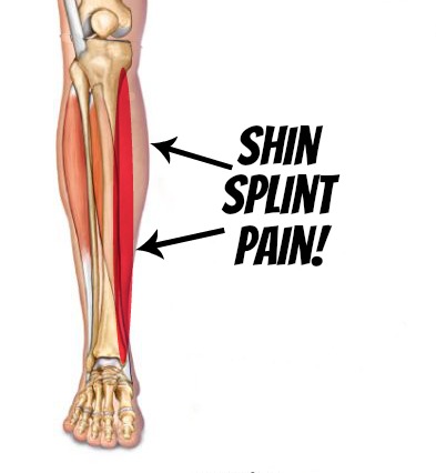 Shin-Splint-Pain.jpg